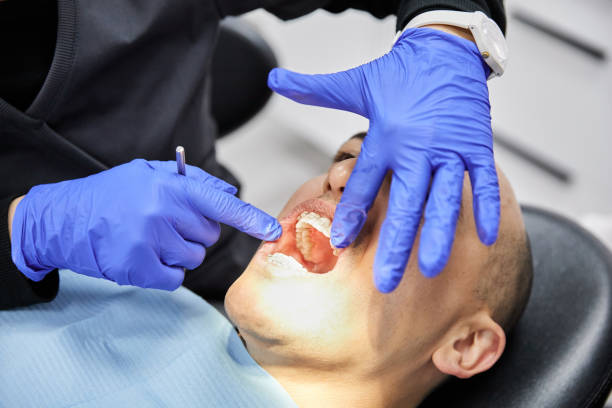 Best Dentist for Tooth Abscess  in Ilco, WA