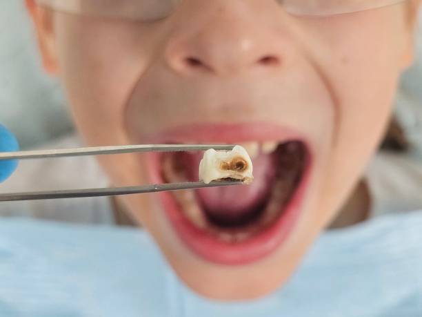 Best Emergency Pediatric Dentist  in Ilco, WA